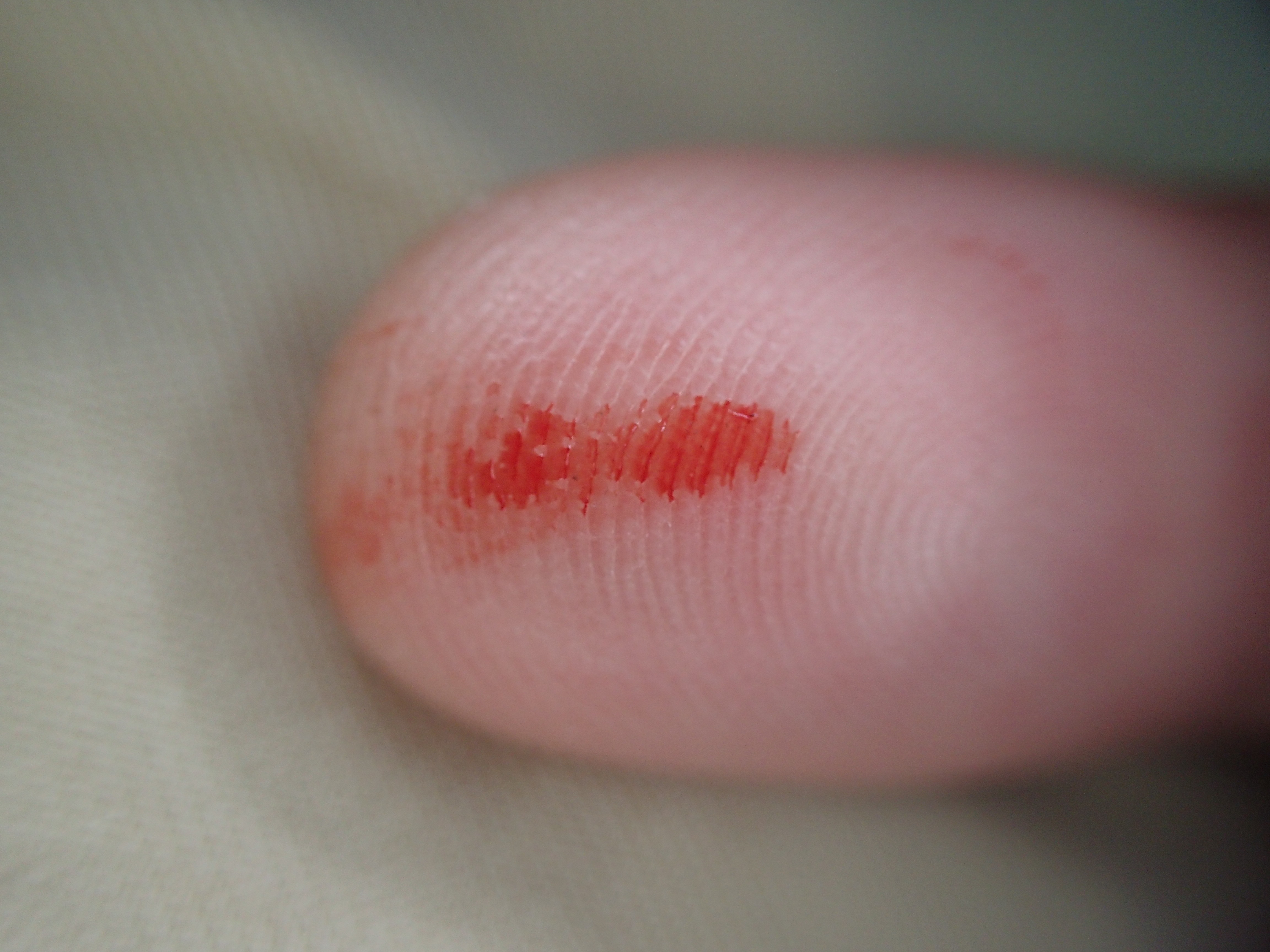 人間の血を吸った蚊を駆除した後に指についた赤い血液